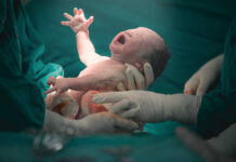 Newborn baby being held by medical staff immediately after birth