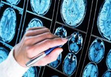 Hand with pen pointing at brain MRI scans