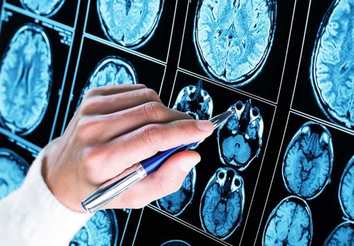 shutterstock_1176078337 Hand with pen pointing at brain MRI scans